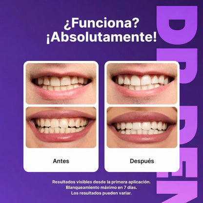 Tiras Blanqueadoras Dentales